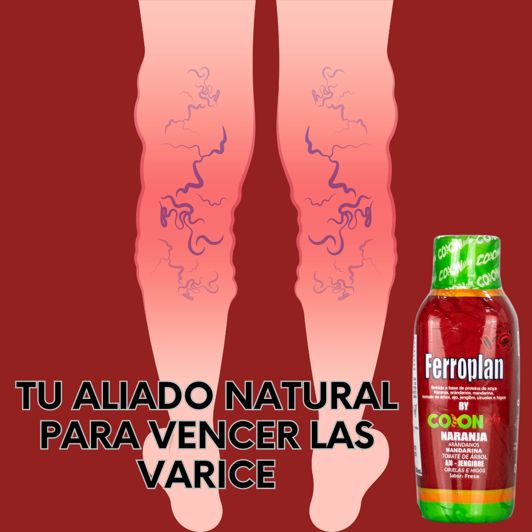 FERROPLAN-Tu aliado natural para vencer las varices🌿